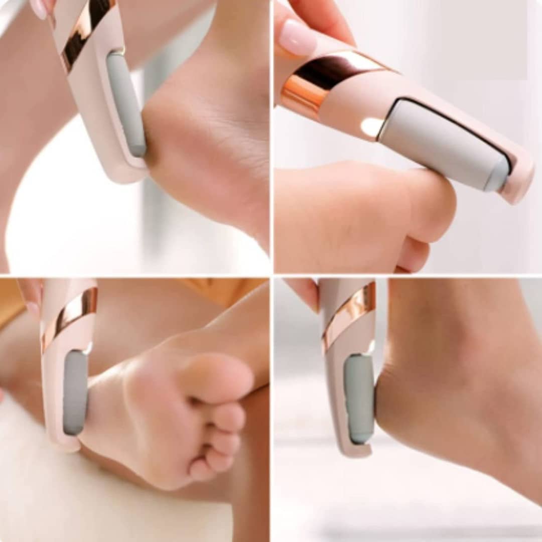 callus remover foot file
